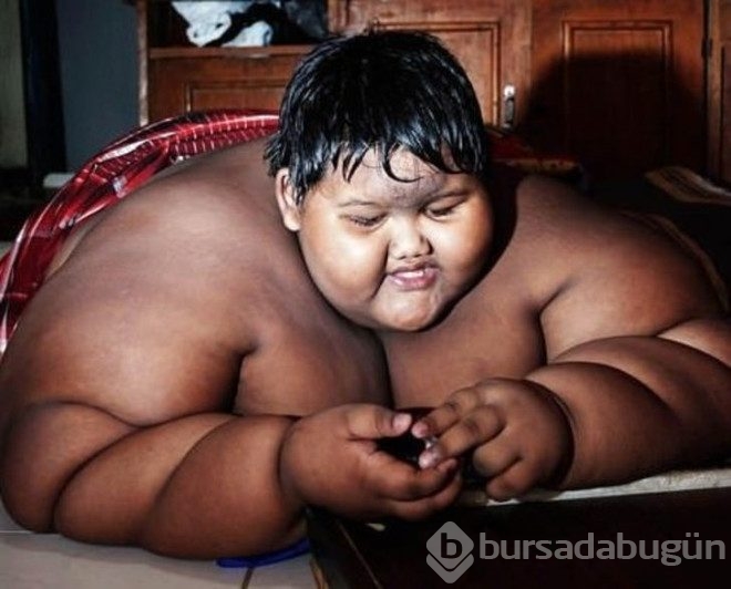 Günde 5 öğün pilav yedi 192 kilo oldu!
