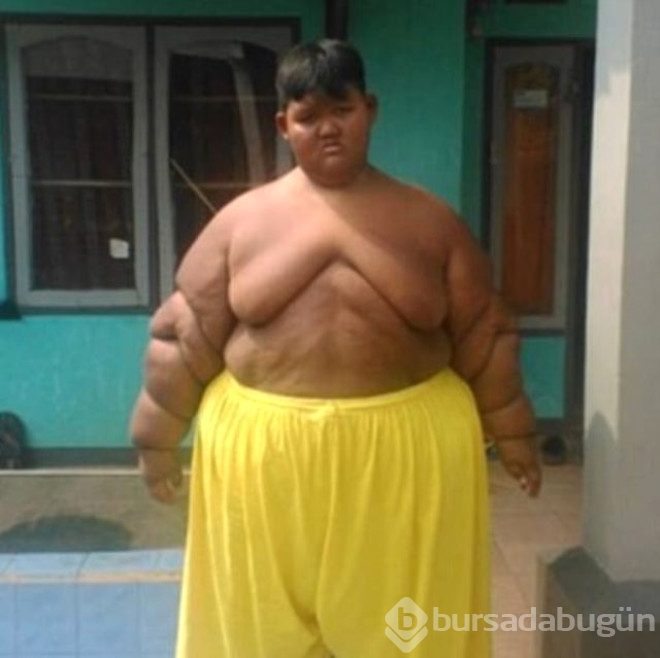 Günde 5 öğün pilav yedi 192 kilo oldu!