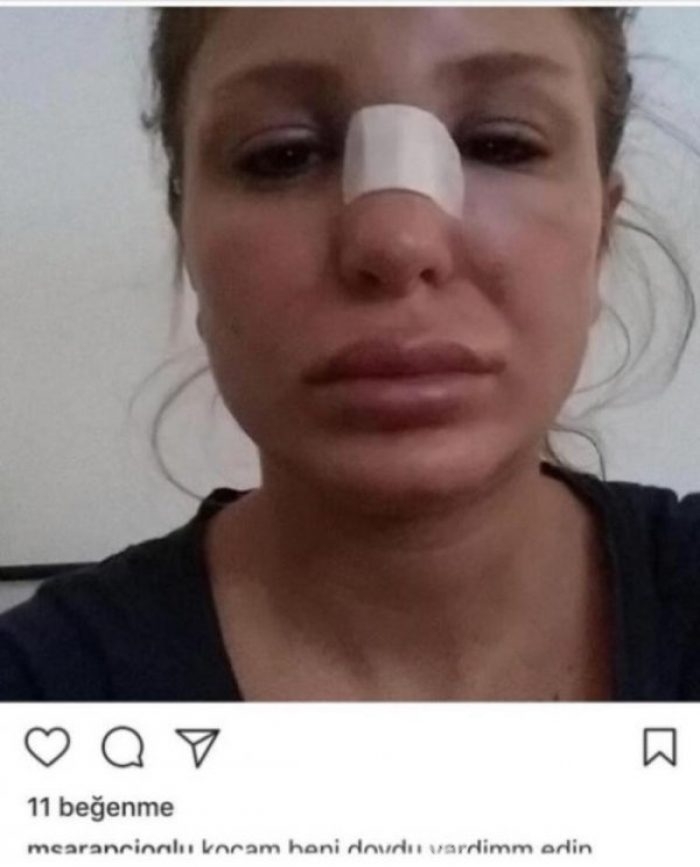 Ünlü oyuncunun eşi: Kocam beni dövdü yardım edin! 