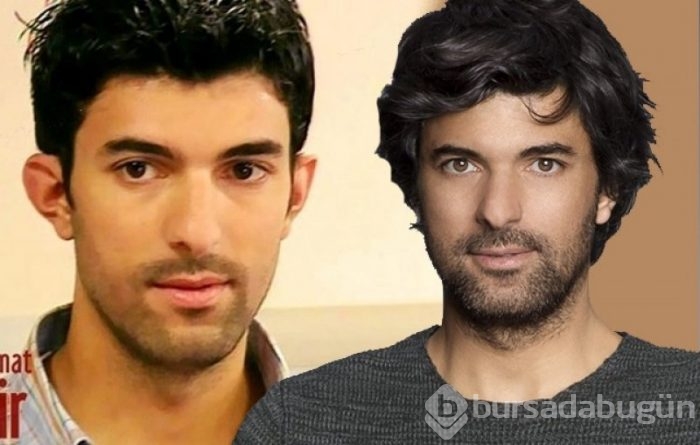 Engin Akyürek'in estetik iddiaları gündeme bomba gibi düştü! 