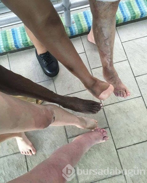 Herkes dalga geçiyordu! Podyumların aranılan yüzü oldu...