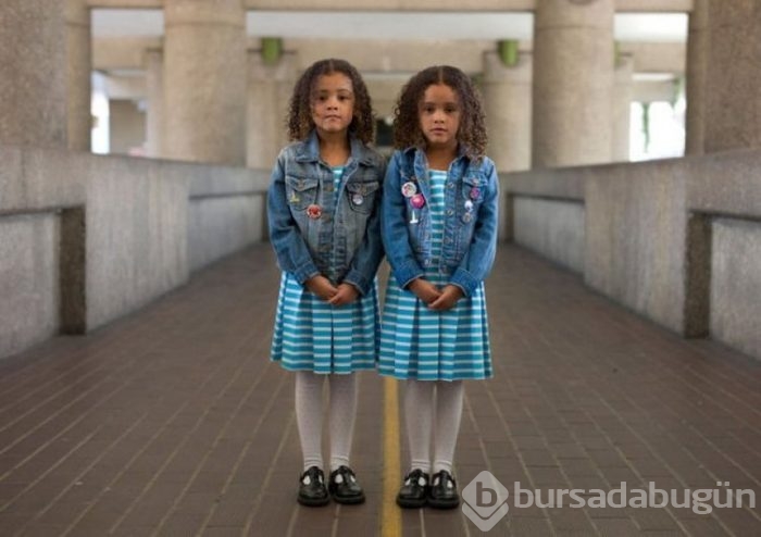 Tek yumurta ikizlerini böyle fotoğrafladı!
