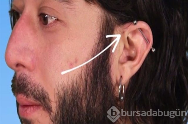 Kulaktaki küçük delikler ne anlama geliyor?
