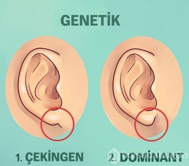 Kulaktaki küçük delikler ne anlama geliyor?
