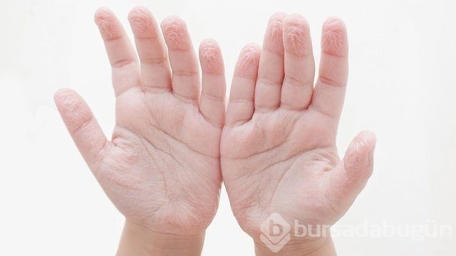Kulaktaki küçük delikler ne anlama geliyor?
