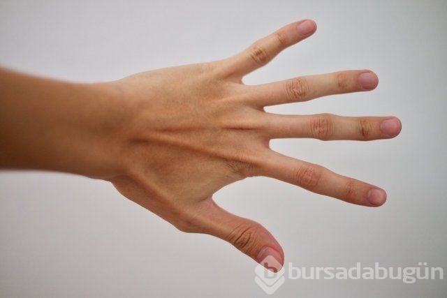 Kulaktaki küçük delikler ne anlama geliyor?
