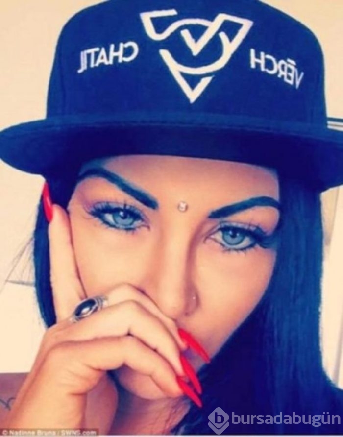 Ünlü isme şok! Göz rengini değiştirmek isterken gözünden oldu!