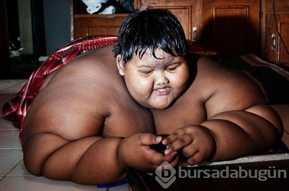 Dünyanın en şişman çocuğuydu...Tam 83 kilo verdi!