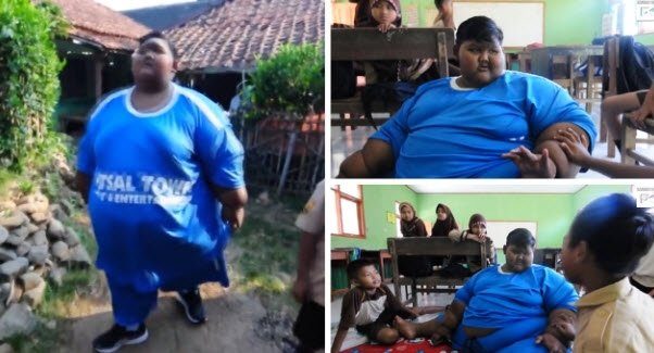 Dünyanın en şişman çocuğuydu...Tam 83 kilo verdi!