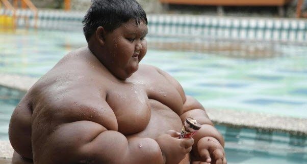 Dünyanın en şişman çocuğuydu...Tam 83 kilo verdi!