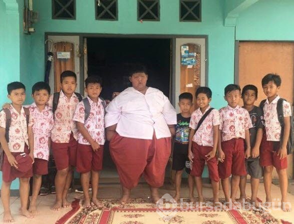 Dünyanın en şişman çocuğuydu...Tam 83 kilo verdi!