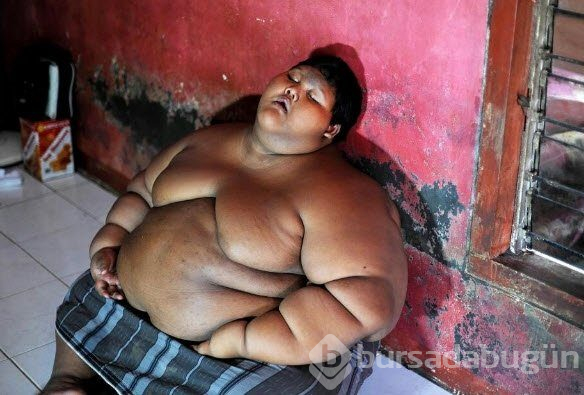 Dünyanın en şişman çocuğuydu...Tam 83 kilo verdi!