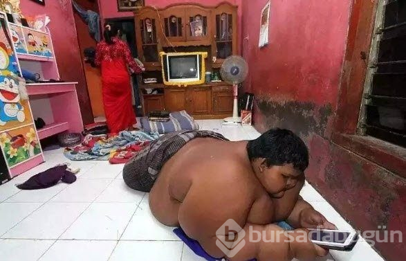 Dünyanın en şişman çocuğuydu...Tam 83 kilo verdi!