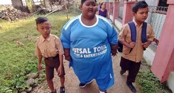 Dünyanın en şişman çocuğuydu...Tam 83 kilo verdi!