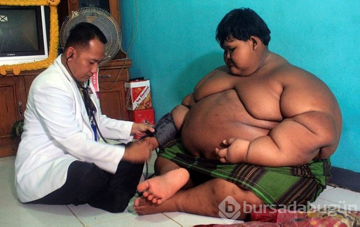 Dünyanın en şişman çocuğuydu...Tam 83 kilo verdi!