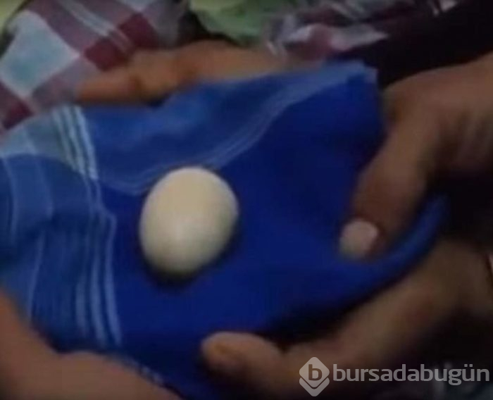 Dikkat! Yıllardır nezle olduğunu sanıyordu gerçek çok farklı çıktı!