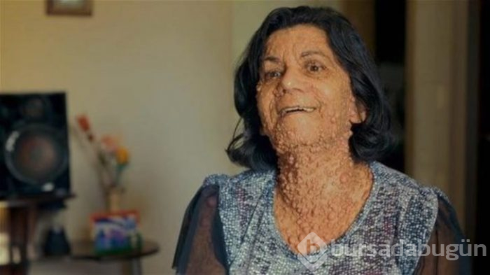 Dikkat! Yıllardır nezle olduğunu sanıyordu gerçek çok farklı çıktı!