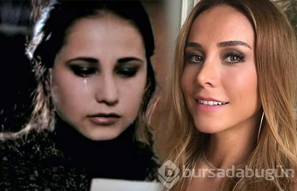 Estetikle başka birine dönüşen Türk ünlüler