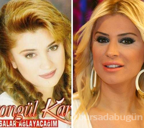 Estetikle başka birine dönüşen Türk ünlüler