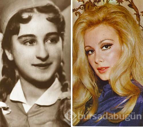 Estetikle başka birine dönüşen Türk ünlüler
