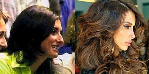 Estetikle başka birine dönüşen Türk ünlüler