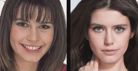 Estetikle başka birine dönüşen Türk ünlüler