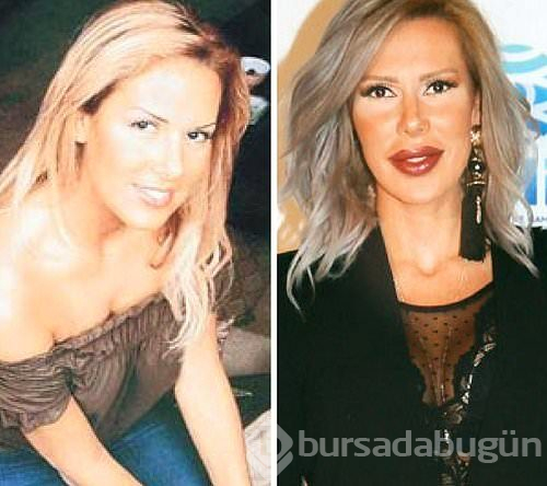 Estetikle başka birine dönüşen Türk ünlüler