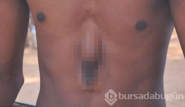 Mucize kurtuluşlar