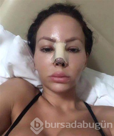 Onbir yılda 200 ameliyat oldu
