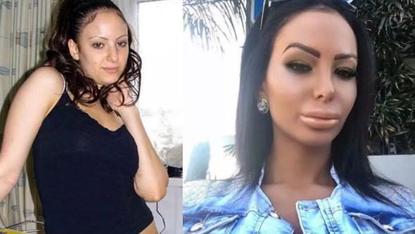 Onbir yılda 200 ameliyat oldu
