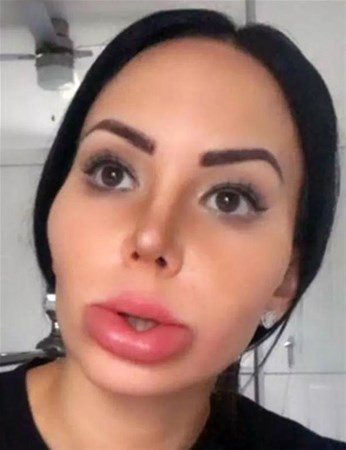 Onbir yılda 200 ameliyat oldu
