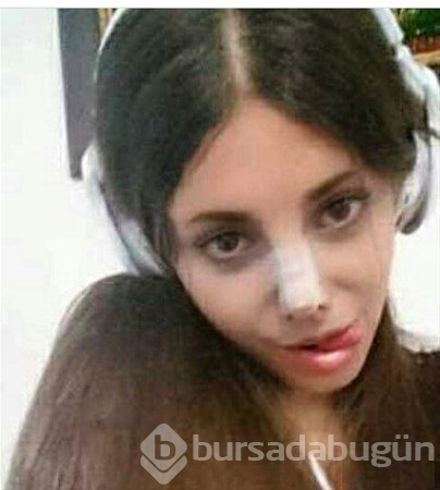 Estetikle bu hale geldi