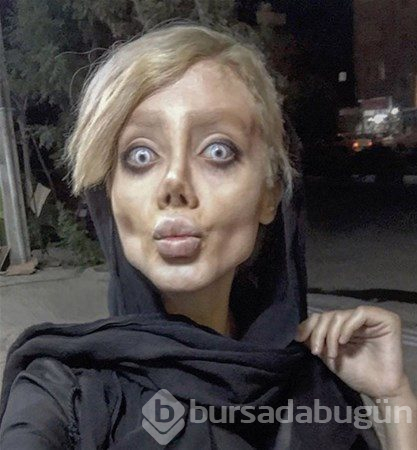 Estetikle bu hale geldi