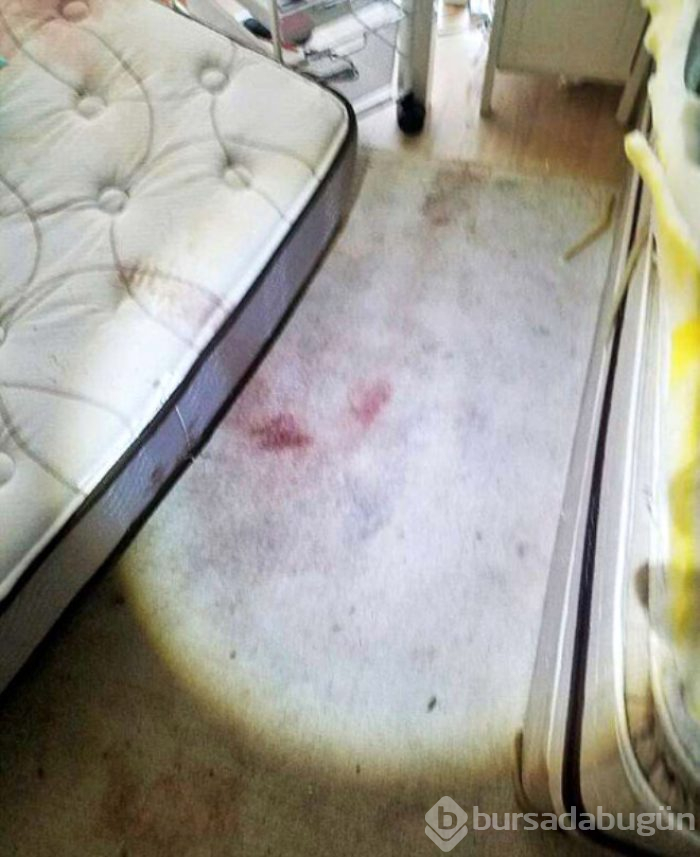 Sevgilisinin kafasını kesip, derisini yüzmüştü...
