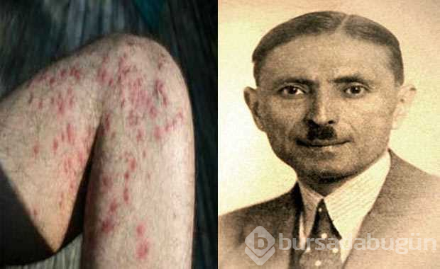 Hastalıkların isimlerinin nereden geldiğini biliyor musunuz?
