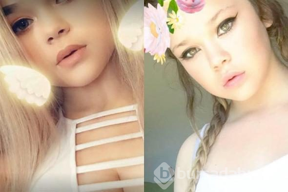 15 yaşında dehşeti yaşadı... Ailesi ibret olsun diye bu fotoğrafı paylaştı!
