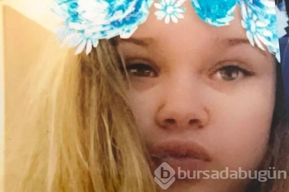 15 yaşında dehşeti yaşadı... Ailesi ibret olsun diye bu fotoğrafı paylaştı!
