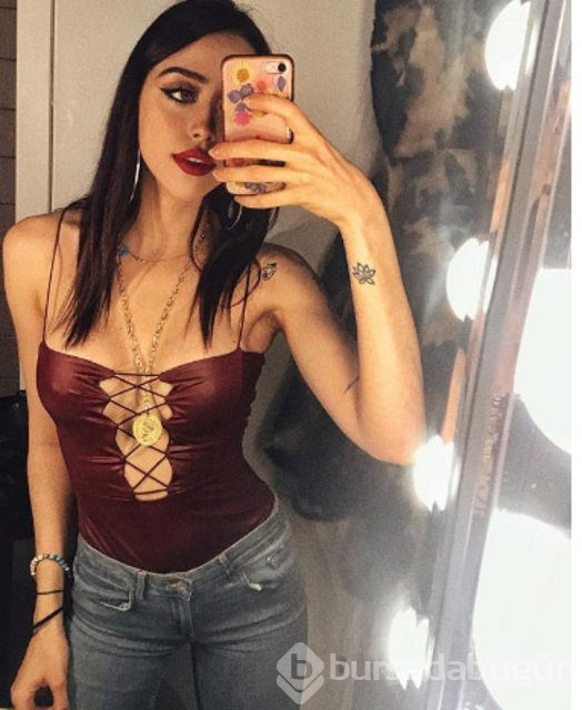 Zeynep Alkan: Bir süre yere basamayacağım
