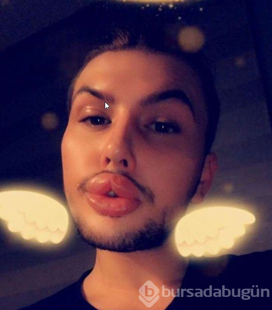 Estetik bağımlılığı bunu da yaptırdı!

