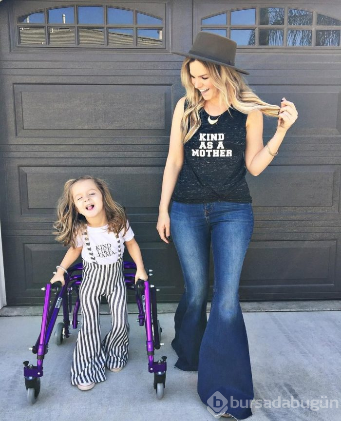 Serebral palsi hastası Instagram fenomeni: Finley Smallwood
