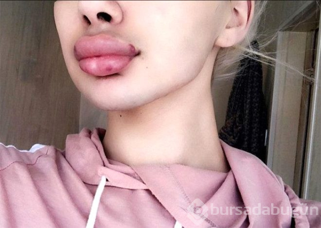 Kim Kardashian'a benzemek isteyen trans genç şoke etti