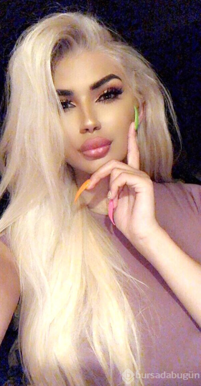 Kim Kardashian'a benzemek isteyen trans genç şoke etti
