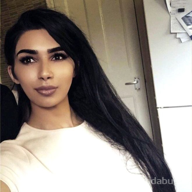 Kim Kardashian'a benzemek isteyen trans genç şoke etti