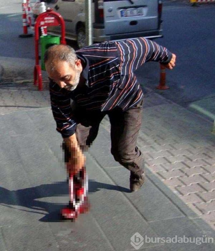 Acemi kasaplar hastanelik oldu