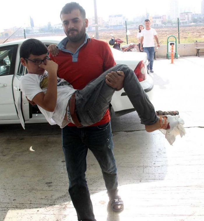 Acemi kasaplar hastanelik oldu