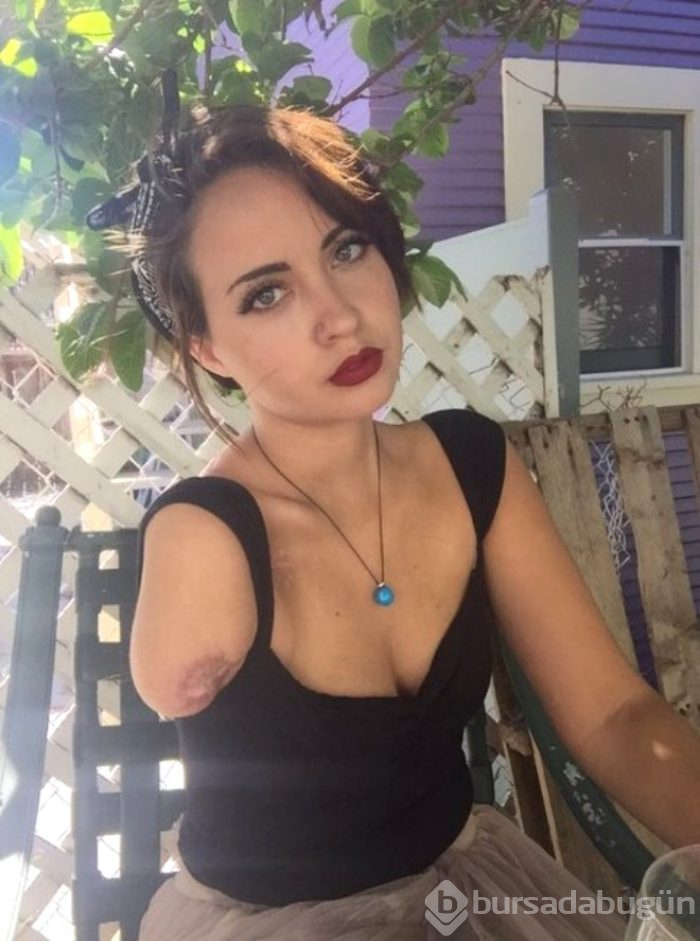 Tek kolunu kaybeden Lauren Tinder açıkmasası ile fenomen oldu 