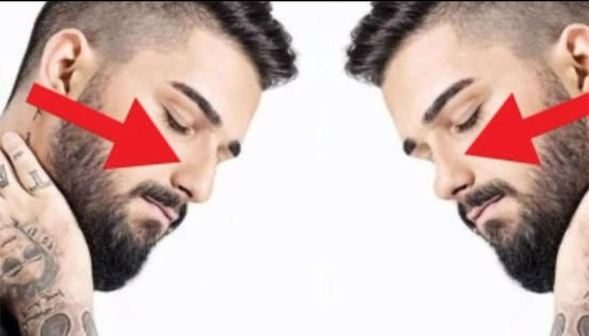 Mustafa Sandal estetik mi yaptırdı? (Güzelleşmek için bıçak altına yatıp estetik olan ünlüler)
