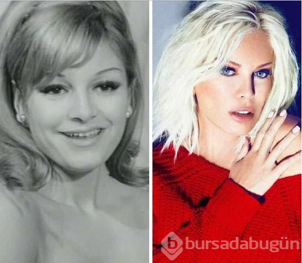 Mustafa Sandal estetik mi yaptırdı? (Güzelleşmek için bıçak altına yatıp estetik olan ünlüler)
