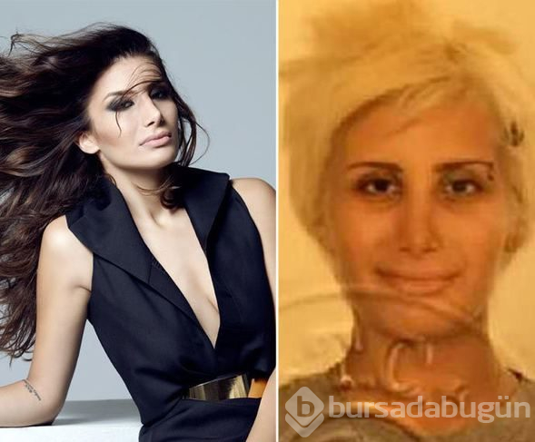 Mustafa Sandal estetik mi yaptırdı? (Güzelleşmek için bıçak altına yatıp estetik olan ünlüler)
