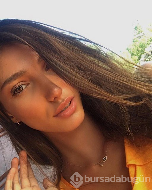2018 Miss Turkey birincisi Şevval Şahin'in estetiksiz hali ortaya çıktı
